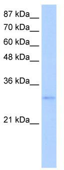 Western blot analysis of extracts of various cell lines, using AKT1 antibody (TA373413) at 1:1000 dilution.|Secondary antibody: HRP Goat Anti-Rabbit IgG (H+L) at 1:10000 dilution.|Lysates/proteins: 25ug per lane.|Blocking buffer: 3% nonfat dry milk in TBST.|Detection: ECL Basic Kit .|Exposure time: 10s.