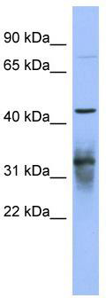 WB Suggested Anti-PABPC5 Antibody Titration: 0.2-1 ug/ml; ELISA Titer: 1: 312500; Positive Control: NCI-H226 cell lysate