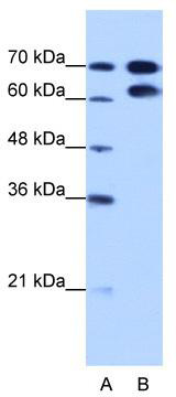 WB Suggested Anti-RAVER1 Antibody Titration: 1.25 ug/ml; Positive Control: HepG2 cell lysate