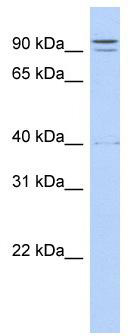 WB Suggested Anti-TTC14 Antibody Titration: 0.2-1 ug/ml; ELISA Titer: 1: 62500; Positive Control: Transfected 293T