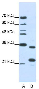 Western blot analysis of extracts from normal (control) and AKT2 knockout (KO) 293T cells, using AKT2 antibody (TA373424) at 1:3000 dilution.|Secondary antibody: HRP Goat Anti-Rabbit IgG (H+L) at 1:10000 dilution.|Lysates/proteins: 25ug per lane.|Blocking buffer: 3% nonfat dry milk in TBST.|Detection: ECL Basic Kit .|Exposure time: 90s.