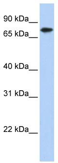 WB Suggested Anti-KLHL23 Antibody Titration: 0.2-1 ug/ml; ELISA Titer: 1: 62500; Positive Control: Transfected 293T