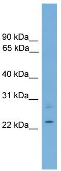 WB Suggested Anti-RBM11 Antibody Titration: 0.2-1 ug/ml; ELISA Titer: 1: 62500; Positive Control: 721_B cell lysate