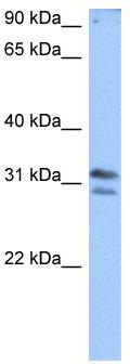 WB Suggested Anti-RG9MTD3 Antibody Titration: 0.2-1 ug/ml; Positive Control: Jurkat cell lysate