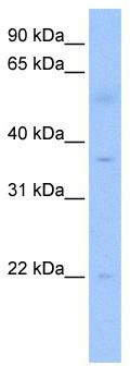 WB Suggested Anti-RG9MTD3 Antibody Titration: 0.2-1 ug/ml; Positive Control: Human heart