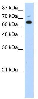 WB Suggested Anti-MGC27016 Antibody Titration: 0.2-1 ug/ml; Positive Control: Jurkat cell lysate