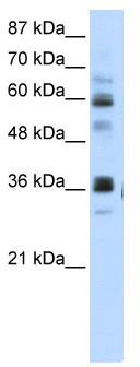 WB Suggested Anti-RPUSD2 Antibody Titration: 5.0 ug/ml; Positive Control: HepG2 cell lysate
