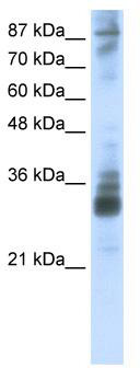 WB Suggested Anti-RG9MTD2 Antibody Titration: 2.5 ug/ml; Positive Control: HepG2 cell lysate