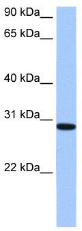WB Suggested Anti-RALYL Antibody Titration: 0.2-1 ug/ml; Positive Control: HepG2 cell lysate