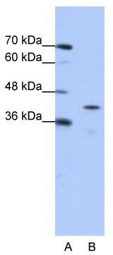 WB Suggested Anti-CPEB2 Antibody Titration: 0.2-1 ug/ml; ELISA Titer: 1: 312500; Positive Control: Jurkat cell lysate