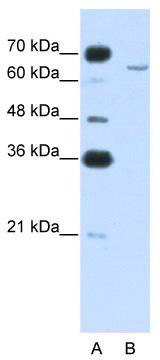 WB Suggested Anti-CPEB2 Antibody Titration: 0.2-1 ug/ml; ELISA Titer: 1: 62500; Positive Control: Jurkat cell lysate