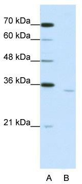 WB Suggested Anti-CPEB2 Antibody Titration: 1.25 ug/ml; ELISA Titer: 1: 62500; Positive Control: Jurkat cell lysate