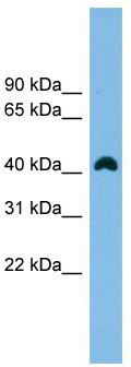 Western blot analysis of extracts of HeLa cells, using Alkaline Phosphatase (ALPL) antibody (TA373474) at 1:1000 dilution.|Secondary antibody: HRP Goat Anti-Rabbit IgG (H+L) at 1:10000 dilution.|Lysates/proteins: 25ug per lane.|Blocking buffer: 3% nonfat dry milk in TBST.|Detection: ECL Basic Kit .|Exposure time: 180s.