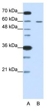 WB Suggested Anti-FZD5 Antibody Titration: 0.2-1 ug/ml; ELISA Titer: 1: 1562500; Positive Control: HepG2 cell lysateFZD5 is strongly supported by BioGPS gene expression data to be expressed in Human HepG2 cells