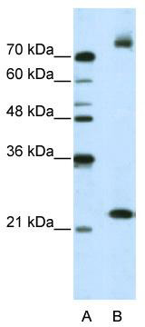 WB Suggested Anti-FZD9 Antibody Titration: 2.5 ug/ml; Positive Control: Jurkat cell lysate