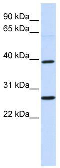 WB Suggested Anti-WNT16 Antibody Titration: 0.2-1 ug/ml; ELISA Titer: 1: 312500; Positive Control: Human brain