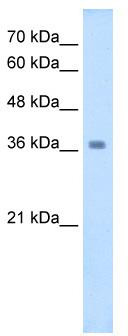 WB Suggested Anti-WNT16 Antibody Titration: 2.5 ug/ml; Positive Control: HepG2 cell lysate