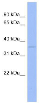 WB Suggested Anti-WNT5B Antibody Titration: 0.2-1 ug/ml; ELISA Titer: 1: 62500; Positive Control: Human Small Intestine