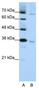 WB Suggested Anti-WNT5B Antibody Titration: 1.25 ug/ml; Positive Control: HepG2 cell lysate