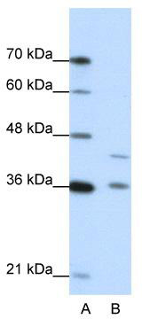 WB Suggested Anti-NKD2 Antibody Titration: 0.2-1 ug/ml; Positive Control: Jurkat cell lysate