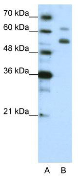 WB Suggested Anti-WDR4 Antibody Titration: 1.25 ug/ml; Positive Control: HepG2 cell lysate
