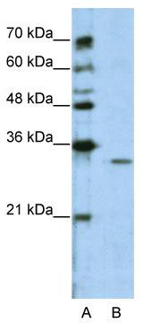 WB Suggested Anti-GNB1L Antibody Titration: 2.5 ug/ml; Positive Control: Jurkat cell lysate