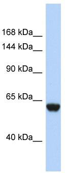 Host: Rabbit; Target Name: FHR4; Sample Tissue: 721_B Whole Cell lysates; Antibody Dilution: 1.0 ug/ml