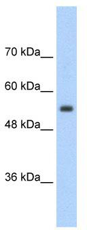 WB Suggested Anti-SLC13A3 Antibody Titration: 2.5 ug/ml; Positive Control: Jurkat cell lysate