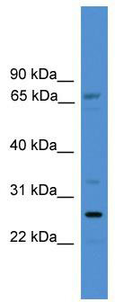 WB Suggested Anti-SLC13A3 Antibody Titration: 0.2-1 ug/ml; ELISA Titer: 1: 312500; Positive Control: ACHN cell lysate