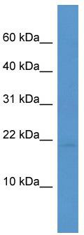 Western blot analysis of extracts of 293T cells, using DNMT1 antibody (TA375561) at 1:1000 dilution.|Secondary antibody: HRP Goat Anti-Rabbit IgG (H+L) at 1:10000 dilution.|Lysates/proteins: 25ug per lane.|Blocking buffer: 3% nonfat dry milk in TBST.|Detection: ECL Basic Kit .|Exposure time: 3s.