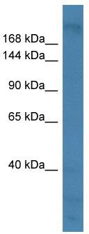 WB Suggested Anti-ANK1 Antibody Titration: 0.2-1 ug/ml; ELISA Titer: 1: 12500; Positive Control: HT1080 cell lysate