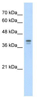 WB Suggested Anti-LOR Antibody Titration: 5.0 ug/ml; Positive Control: HepG2 cell lysate