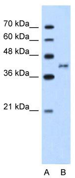 Western blot analysis of extracts of various cell lines, using DTNA antibody (TA375639) at 1:3000 dilution.|Secondary antibody: HRP Goat Anti-Rabbit IgG (H+L) at 1:10000 dilution.|Lysates/proteins: 25ug per lane.|Blocking buffer: 3% nonfat dry milk in TBST.|Detection: ECL Basic Kit .|Exposure time: 10s.