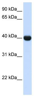 WB Suggested Anti-ADH1A Antibody Titration: 0.2-1 ug/ml; ELISA Titer: 1: 62500; Positive Control: Human Liver