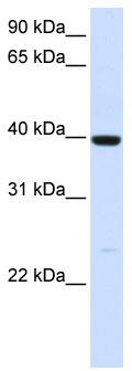 WB Suggested Anti-ADH1A Antibody Titration: 0.2-1 ug/ml; ELISA Titer: 1: 12500; Positive Control: Human Liver