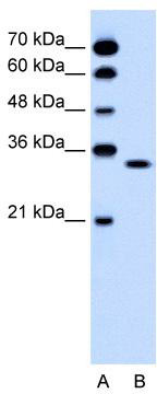 WB Suggested Anti-OR5T2 Antibody Titration: 0.2-1 ug/ml; Positive Control: Jurkat cell lysate
