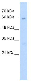 WB Suggested Anti-KIAA0859 Antibody Titration: 2.5 ug/ml; Positive Control: HepG2 cell lysate