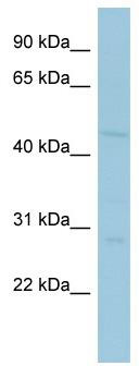 Western blot analysis of extracts of 293T cells, using DZIP3 Antibody (TA375679) at 1:1000 dilution.|Secondary antibody: HRP Goat Anti-Rabbit IgG (H+L) at 1:10000 dilution.|Lysates/proteins: 25ug per lane.|Blocking buffer: 3% nonfat dry milk in TBST.|Detection: ECL Basic Kit .|Exposure time: 15s.