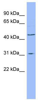 Western blot analysis of extracts of MCF-7 cells, using E2F6 antibody (TA375686) at 1:1000 dilution.|Secondary antibody: HRP Goat Anti-Rabbit IgG (H+L) at 1:10000 dilution.|Lysates/proteins: 25ug per lane.|Blocking buffer: 3% nonfat dry milk in TBST.|Detection: ECL Basic Kit .|Exposure time: 90s.