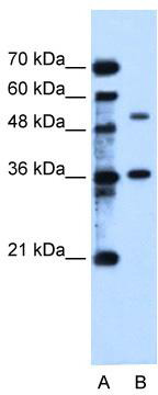 Western blot analysis of extracts of various cell lines, using ECM1  antibody (TA375701) at 1:1000 dilution.|Secondary antibody: HRP Goat Anti-Rabbit IgG (H+L) at 1:10000 dilution.|Lysates/proteins: 25ug per lane.|Blocking buffer: 3% nonfat dry milk in TBST.|Detection: ECL Basic Kit .|Exposure time: 10s.