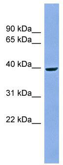 Western blot analysis of extracts of various cell lines, using EDAR antibody (TA375704) at 1:1000 dilution.|Secondary antibody: HRP Goat Anti-Rabbit IgG (H+L) at 1:10000 dilution.|Lysates/proteins: 25ug per lane.|Blocking buffer: 3% nonfat dry milk in TBST.|Detection: ECL Enhanced Kit .|Exposure time: 90s.