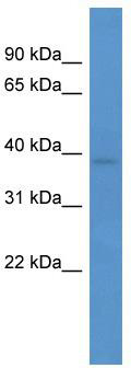WB Suggested Anti-Cpa3 Antibody Titration: 0.2-1 ug/ml; ELISA Titer: 1: 62500; Positive Control: Mouse Kidney
