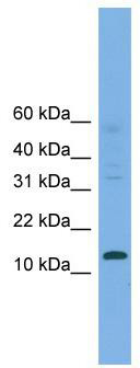 WB Suggested Anti-CRABP2 Antibody Titration: 0.2-1 ug/ml; ELISA Titer: 1: 1562500; Positive Control: PANC1 cell lysate.CRABP2 is supported by BioGPS gene expression data to be expressed in PANC1