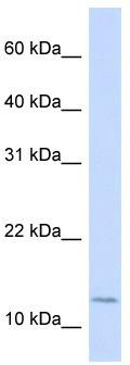 WB Suggested Anti-CRABP2 Antibody Titration: 0.2-1 ug/ml; ELISA Titer: 1: 62500; Positive Control: 721_B cell lysate