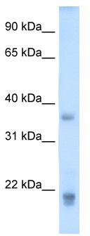 Western blot analysis of extracts of A-549 cells, using EGFR antibody (TA375746) at 1:1000 dilution.|Secondary antibody: HRP Goat Anti-Rabbit IgG (H+L) at 1:10000 dilution.|Lysates/proteins: 25ug per lane.|Blocking buffer: 3% nonfat dry milk in TBST.|Detection: ECL Basic Kit .|Exposure time: 30s.