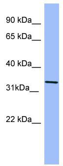 Western blot analysis of extracts from normal (control) and EGFR knockout (KO) HeLa cells, using EGFR antibody (TA375749) at 1:3000 dilution.|Secondary antibody: HRP Goat Anti-Rabbit IgG (H+L) at 1:10000 dilution.|Lysates/proteins: 25ug per lane.|Blocking buffer: 3% nonfat dry milk in TBST.|Detection: ECL Basic Kit .|Exposure time: 3s.