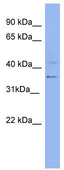 Western blot analysis of extracts of OVCAR3 cells, using EGFR Rabbit pAb (TA375750) at 1:3000 dilution.|Secondary antibody: HRP Goat Anti-Rabbit IgG (H+L) at 1:10000 dilution.|Lysates/proteins: 25ug per lane.|Blocking buffer: 3% nonfat dry milk in TBST.|Detection: ECL Basic Kit .|Exposure time: 10s.