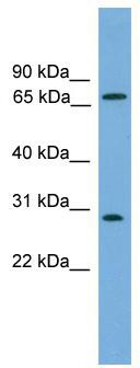 WB Suggested Anti-SEMG2 Antibody Titration: 0.2-1 ug/ml; ELISA Titer: 1: 312500; Positive Control: COLO205 cell lysate