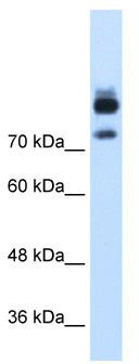 WB Suggested Anti-MTMR1 Antibody Titration: 1.25 ug/ml; Positive Control: HepG2 cell lysate