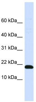 WB Suggested Anti-DNAJC25-GNG10 Antibody Titration: 0.2-1 ug/ml; ELISA Titer: 1: 62500; Positive Control: Human Placenta